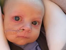 Fundraiser for Charles Derrah by Matt Pasqualetto : Help Issac receive a  new liver