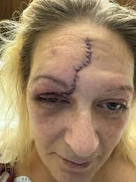 Anyone know what happened in front of the hospital and lifecare?