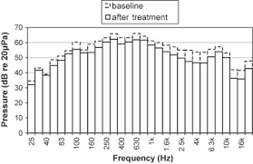 Maybe you would like to learn more about one of these? Hvac Noise Control Using Natural Materials To Improve Vehicle Interior Sound Quality Sciencedirect