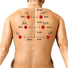 Six Posterior Chest Location For Auscultation Figure 1 Six Posterior Download Scientific Diagram