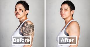 Nowadays, most tattoos are removed through a series of laser treatments. 9 Ex Gang Members With Their Tattoos Removed Bored Panda