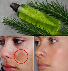 can rosemary help in beautifying the skin