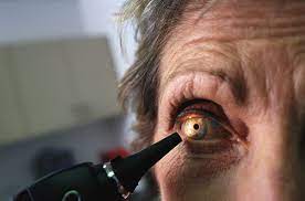 Why More Boomers Are Getting Cataract Surgery At A Younger Age