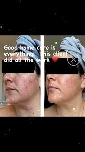 #skincareroutine #ingredientsmatter