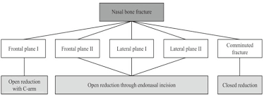 The bones that contribute to a common sequela of nasal fractures is permanent deformity, due to disruption of the bone and. Archives Of Craniofacial Surgery