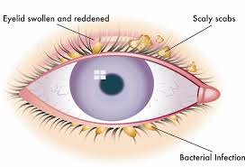 Image result for Blepharis sol