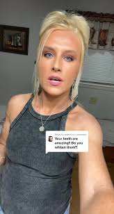 Reply to @xxsmmxx #3dcrest #3dcrestwhite #toothpaste #easternky  #elliottvilleky Here recently I did chip my front tooth if y’all can tell  in the video ☹️ so I need go have it fixed before it starts ...