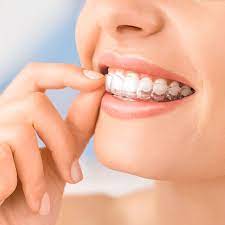 Die therapie mit unserem aligner ist ein system, für das ausreichend klinische erfahrungen gesammelt wurden und weiter aktiv klinische forschung betrieben wird. Aligner Therapie Dentaltrade