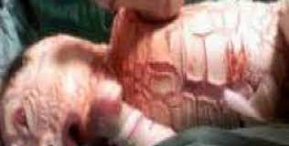 agri da yilan bebek dunyaya geldi ogun haber gunun onemli gelismeleri son dakika haberler