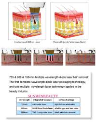 Find out what is the average laser technician salary entry level positions start at $39,975 per year while most experienced workers make up to $77,610 per year. Why Diode Laser Can Remove Hair Permanently Diode Laser Hair Removal Laser Hair Removal Machine Laser Hair Removal