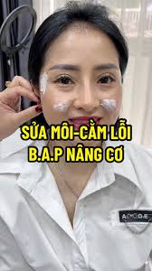 Giải quyết tình trạng tiêm môi và cằm quá nhọn