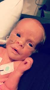 Can you edit NICU baby photos?