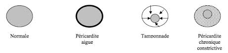 Nos coups de coeur sur les routes de france. Recap Ide La Pericardite