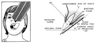 Dental Radiography