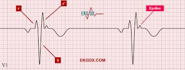 Image result for J Wave