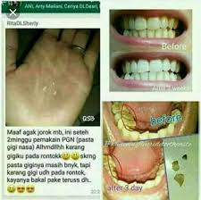 Penghilang Bau Mulut Bisa Untuk Memutihkan Gigi Mengatasi Sakit Gigi Gusi Bengkak Sariawan Pasta Gigi Nasa Di Lapak Toko Herbal Alami Bukalapak