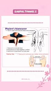 Image result for Carpal Compression Test