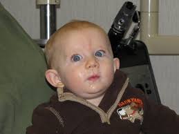 Visual Perception, Accommodation, Vergence, and Oculomotor Function