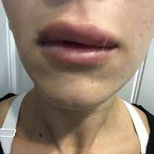 Here's how to get your certification. Aesthetic Medical Educators Training Educational Services 320 N Main St Buda Tx Phone Number Yelp