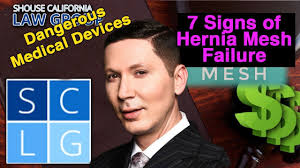 How do i know if i have a hernia mesh case i can pursue? Hernia Mesh Failure Symptoms 7 Signs After Implant Surgery