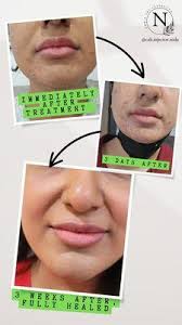 Laguna Wellness and Weight Loss, 24471 Alicia Pkwy, Ste 2, Mission Viejo,  CA 92691, US