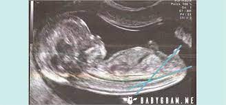 Problematisch wird es aber, wenn die enttäuschung über das «falsche» geschlecht anhält. How Do We Predict Your Baby S Gender Babygram