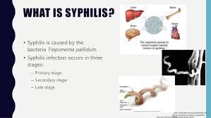 Trep brought to you by: Microbiology Syphilis