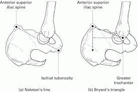 Check spelling or type a new query. 4 The Lower Limb Basicmedical Key