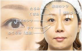 目元のたるみ シワ くま くぼみ等のエイジングケアの種類や料金 共立美容外科