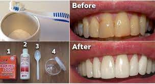 How To Get Rid Of Plaque With This Natural Baking Soda Paste Baking Natural Natural Remedies Baking Baking Soda And Lemon Homemade Mouthwash Natural Baking