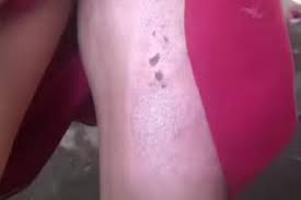 Alasan Tante di Jember Siram Keponakannya dengan Kuah Bakso Panas