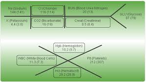 Visualizing Lab Results Qlik Dork