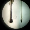 A hair without a bulb means the hair was lost prior to the root. 1