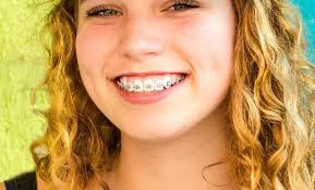 See more ideas about cute braces, brace face, braces colors. American Association Of Orthodontists Friendly Recipes Dr Whitlock