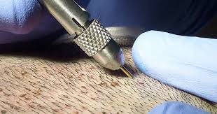 الدكتور وسام عضاضة مركز زراعة الشعر في دبي زراعة الحواجب العنوان و خريطة الوصول رقم الهاتف معلوما Best Hair Transplant Hair Loss Treatment Cool Hairstyles
