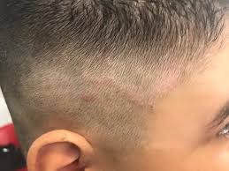 Check spelling or type a new query. Ma Moj 11 Rocny Syn Seboreu Modry Konik