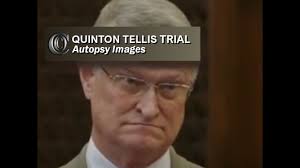 Maybe you would like to learn more about one of these? Quinton Tellis Trial Dr Hickerson Autopsy Pics 2017 Youtube