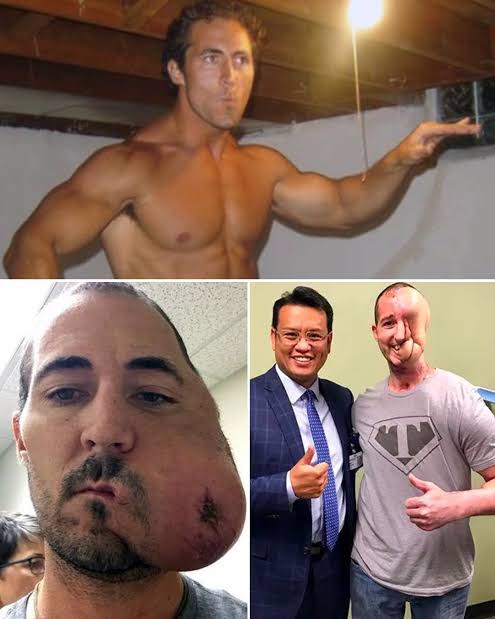 Tim McGrath's journey with synovial sarcoma and facial reconstruction