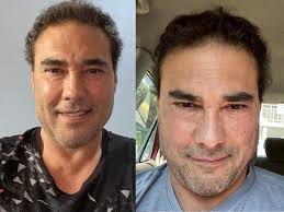 Amores Verdadeiros: Como está o ator que faz Aguiar hoje