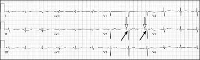 Lesson 11 – Pulse Physiology Learning Through Social Education