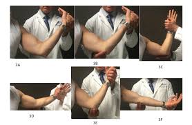 Image result for Elbow Exam