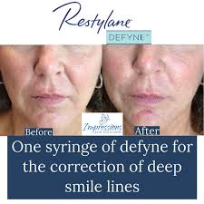 Med Spa in Hendersonville, TN