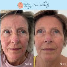 Baby Face Skin Care...