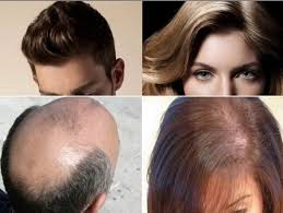 Cara menebalkan rambut tipis secara alami berikut bisa dipraktekkan oleh pria dan wanita. Tips Merawat Tubuh Tetap Sehat Cara Menebalkan Rambut Tipis Secara Alami