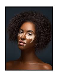 Art Print Vitiligo 16x20 Fashion Beauty Wall Art Vitiligo Model Vitiligo Beauty
