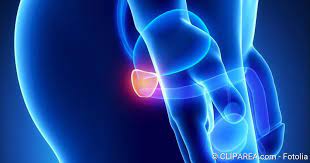 Prostatitis Ausloser Symptome Behandlung Netdoktor