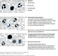 Chapter 3 The Acute Inflammatory Response Concise