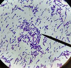 #listeria#monocytogenes#microbiology#virulencefactor#bacteriologyif you like ❤ this video please subscribe to med bees if you have any query or suggestion. Listeria Bacteria Web Ceh