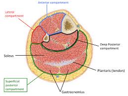 I am not an expert on this subject, so i was wondering if anyone could put their input on this image. Femoral Shaft Fractures Core Em