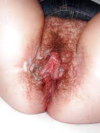 Besamte fotzen - Best adult videos and photos